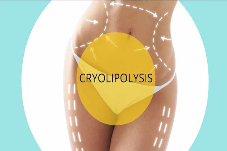 Criyo Lipoiza Brasov